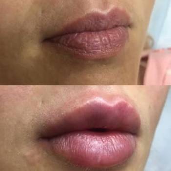 Елена Кузьменко , Київ Фото - 6