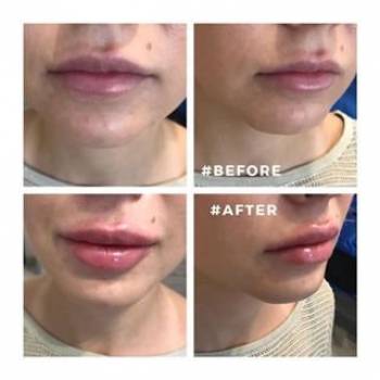 Ольга Тумар , Киев Фото - 5