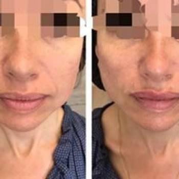 Ольга Тумар , Киев Фото - 6