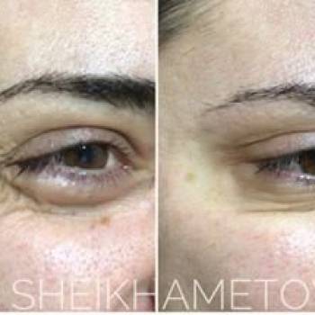 Элмаз Шейхаметова , Киев Фото - 5