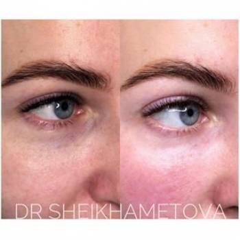 Элмаз Шейхаметова , Киев Фото - 6