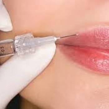 Контурная пластика губ