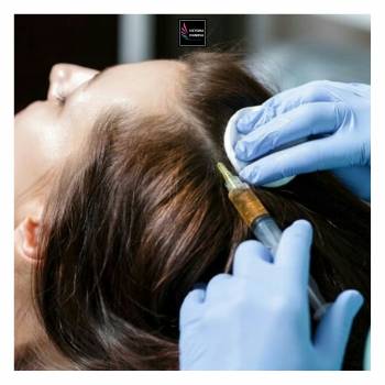 Мезотерапия кожи головы