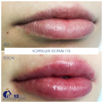 Фото с портфолио Призма