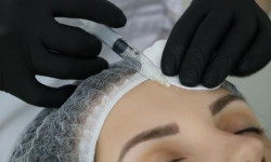 Мезотерапія обличчя Косметологічний центр Olga Sudnyk Academy of Beauty Львів