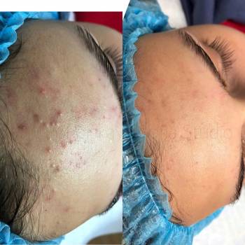 Фото с портфолио София Побойская 