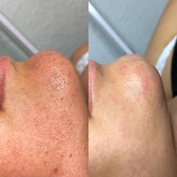 Фото с портфолио София Побойская 