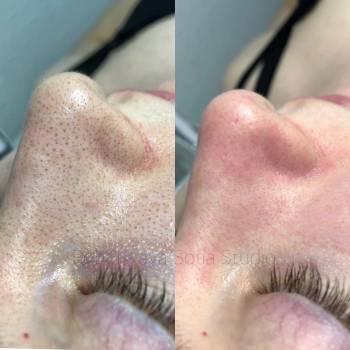 Фото с портфолио София Побойская 