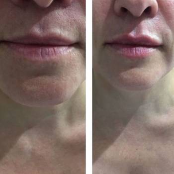 Фото с портфолио Елена 