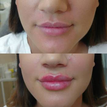 NC Cosmetology, Киев Фото - 5