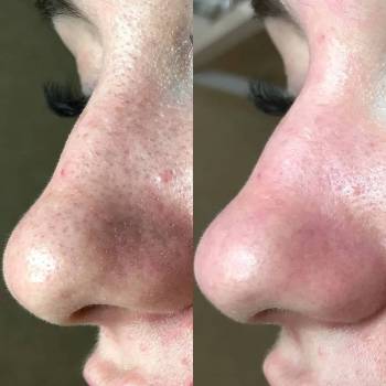 NC Cosmetology, Киев Фото - 6