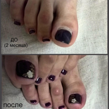 педикюр комбинированный с покрытием гель-лака