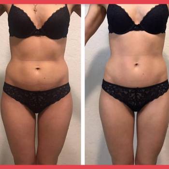 Александр Допира , Київ Фото - 5