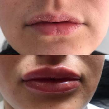 Анастасия Фесенко , Киев Фото - 6