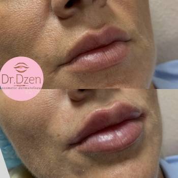 Катерина Дзень , Киев Фото - 5