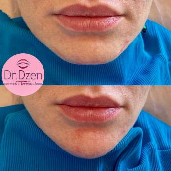 Катерина Дзень , Киев Фото - 6