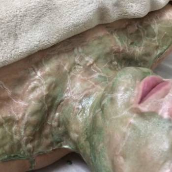 Ферментотерапия DMK