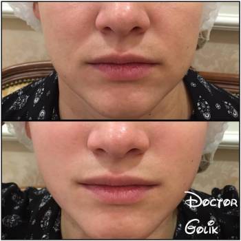 Фото с портфолио Светлана Голик 