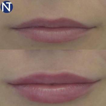 Nove Tilo, Київ Фото - 5