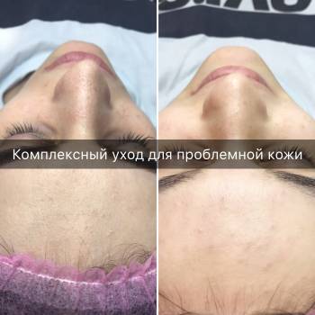 Ольга Пурас , Днепр Фото - 5