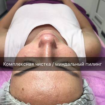 Ольга Пурас , Днепр Фото - 6