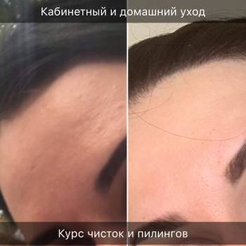 Ольга Пурас , Днепр Фото - 10