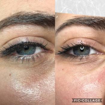 Laser +, Киев Фото - 5