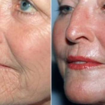 Алиса Игоревна Кирилюк , Одесса Фото - 9