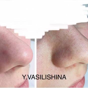 Юлия Василишина , Київ Фото - 11