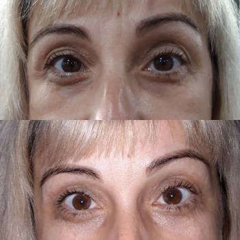 Фото с портфолио Ірина Яковчук