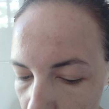 Атравматическая чистка+осветление+увлажнение фото до. Космет