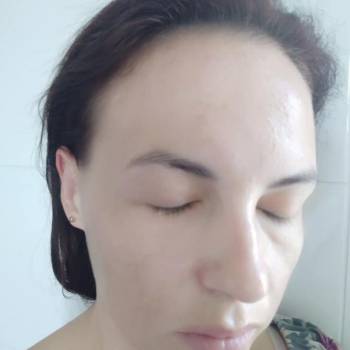 Атравматическая чистка+осветление+увлажнение фото после.
Кос