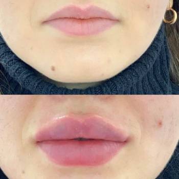 Алёна Андросова , Кривий Ріг Фото - 5