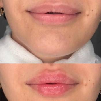 Алёна Андросова , Кривий Ріг Фото - 7