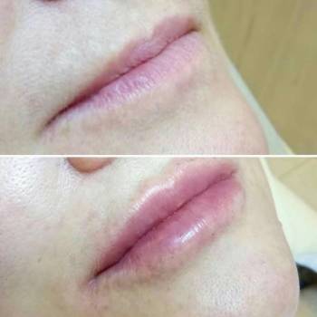 Алёна Андросова , Кривий Ріг Фото - 8