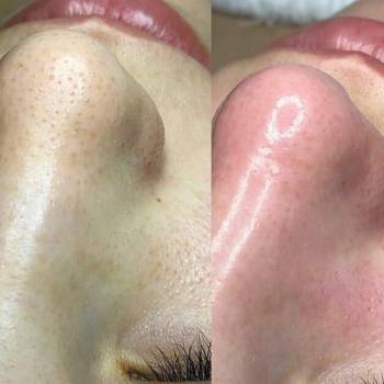 Алёна Андросова , Кривий Ріг Фото - 10