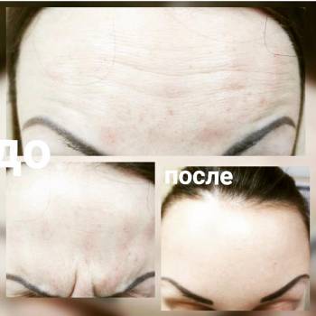 Алёна Андросова , Кривий Ріг Фото - 14