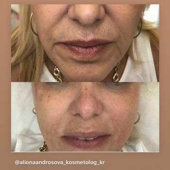 Алёна Андросова , Кривий Ріг Фото - 15