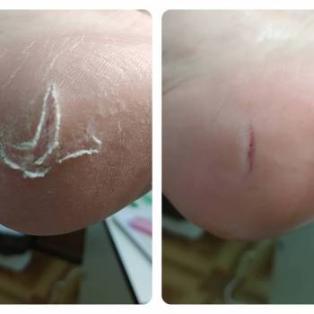 Веста Меладзе, Одесса Фото - 11