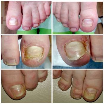 Веста Меладзе, Одесса Фото - 7