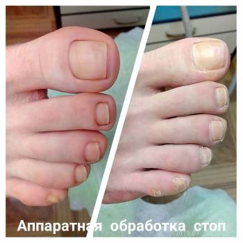 Веста Меладзе, Одесса Фото - 8