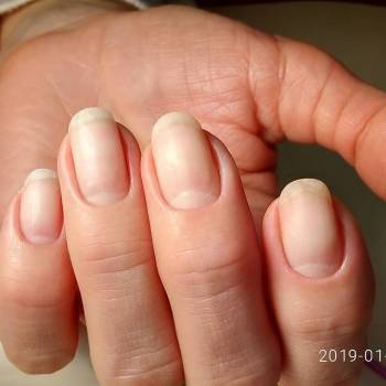 Веста Меладзе, Одесса Фото - 5