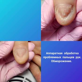 Веста Меладзе, Одесса Фото - 4