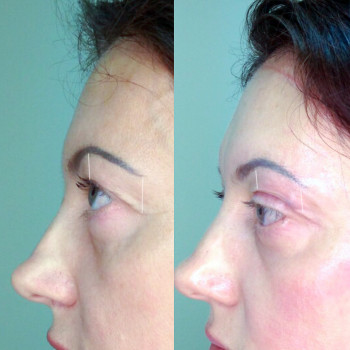 Фото с портфолио Центр Омоложения