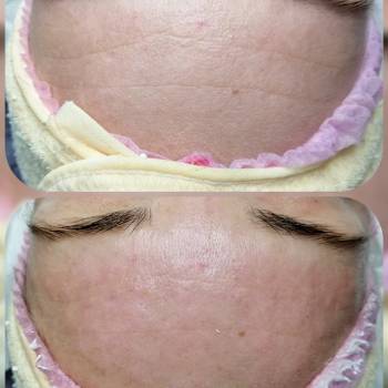 Александр Капелька , Кривой Рог Фото - 5