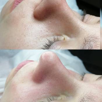 Александр Капелька , Кривой Рог Фото - 6