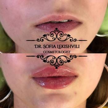 Фото с портфолио София 