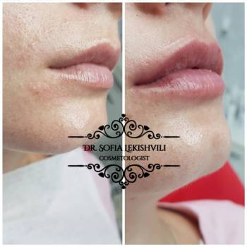 Фото с портфолио София 