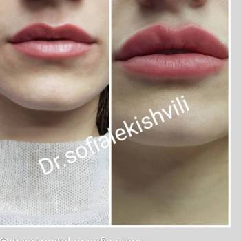 Фото с портфолио София 