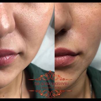 Фото с портфолио София 